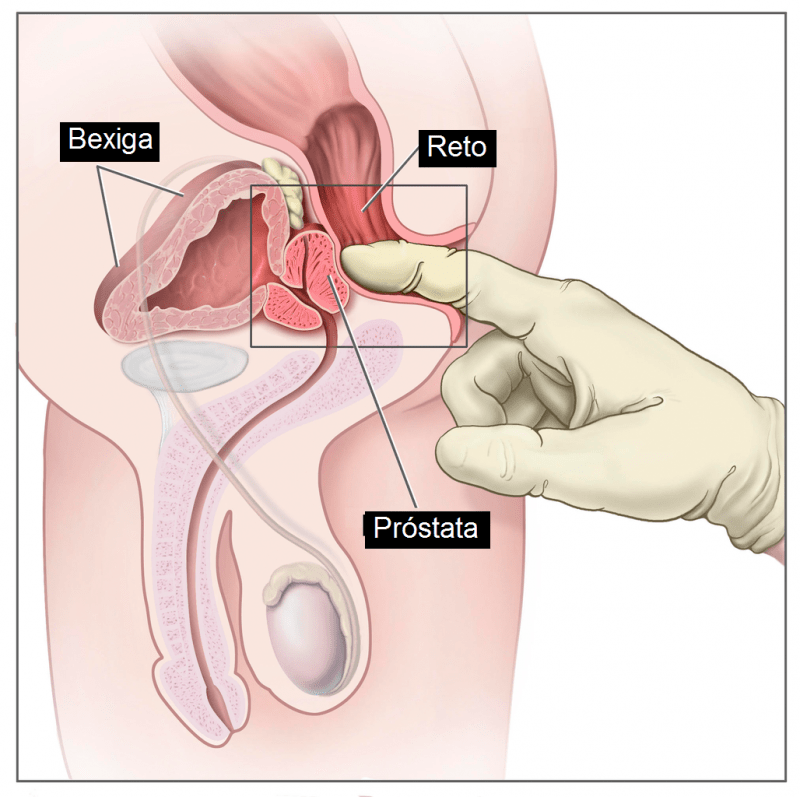 ilustração com mão mostrando a localização da próstata